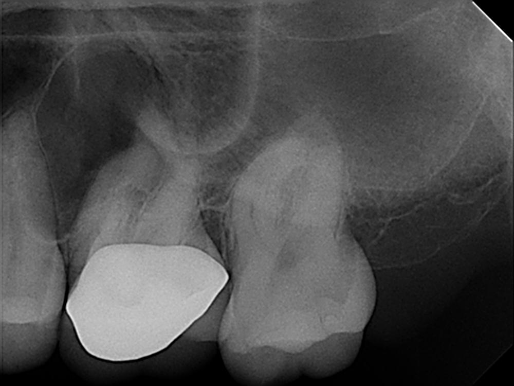 10_100635_Pre-op1_.thumb.jpg.f1fc15316516da49c75de9a64e018ae9